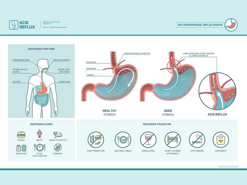 CBD et reflux sophagien | Cannabinodes et gastrite Eusphera CBD et reflux sophagien | Cannabinodes et gastrite Eusphera