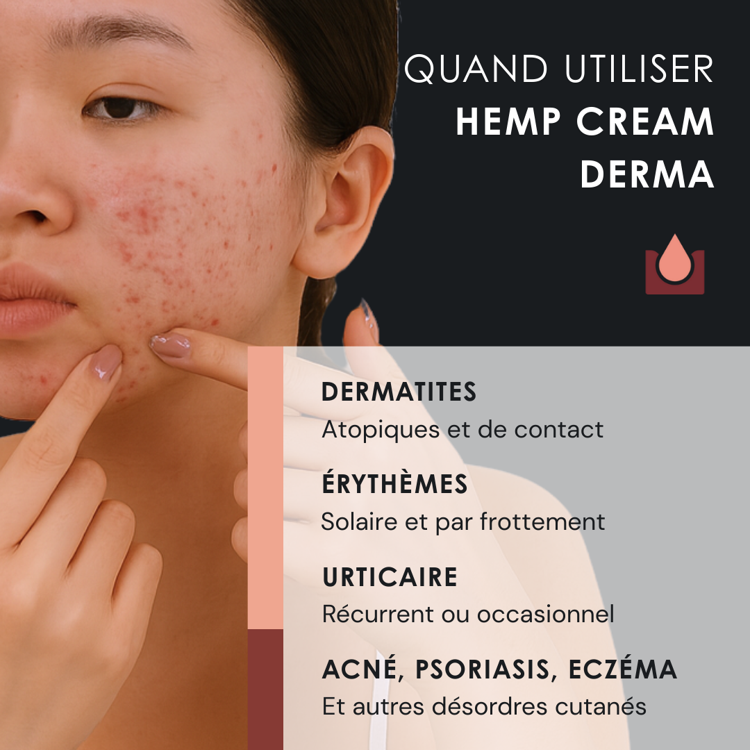 EU4SKIN - Crème apaisante naturelle pour le visage et le corps contre l'eczéma, l'acné et le psoriasis - 50 ml