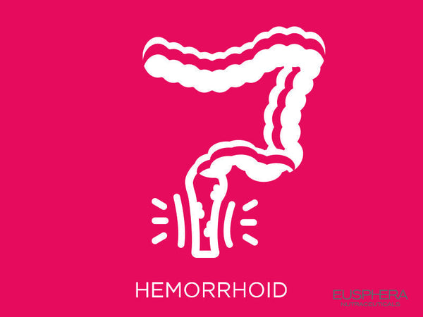 CBD bei Hämorrhoiden