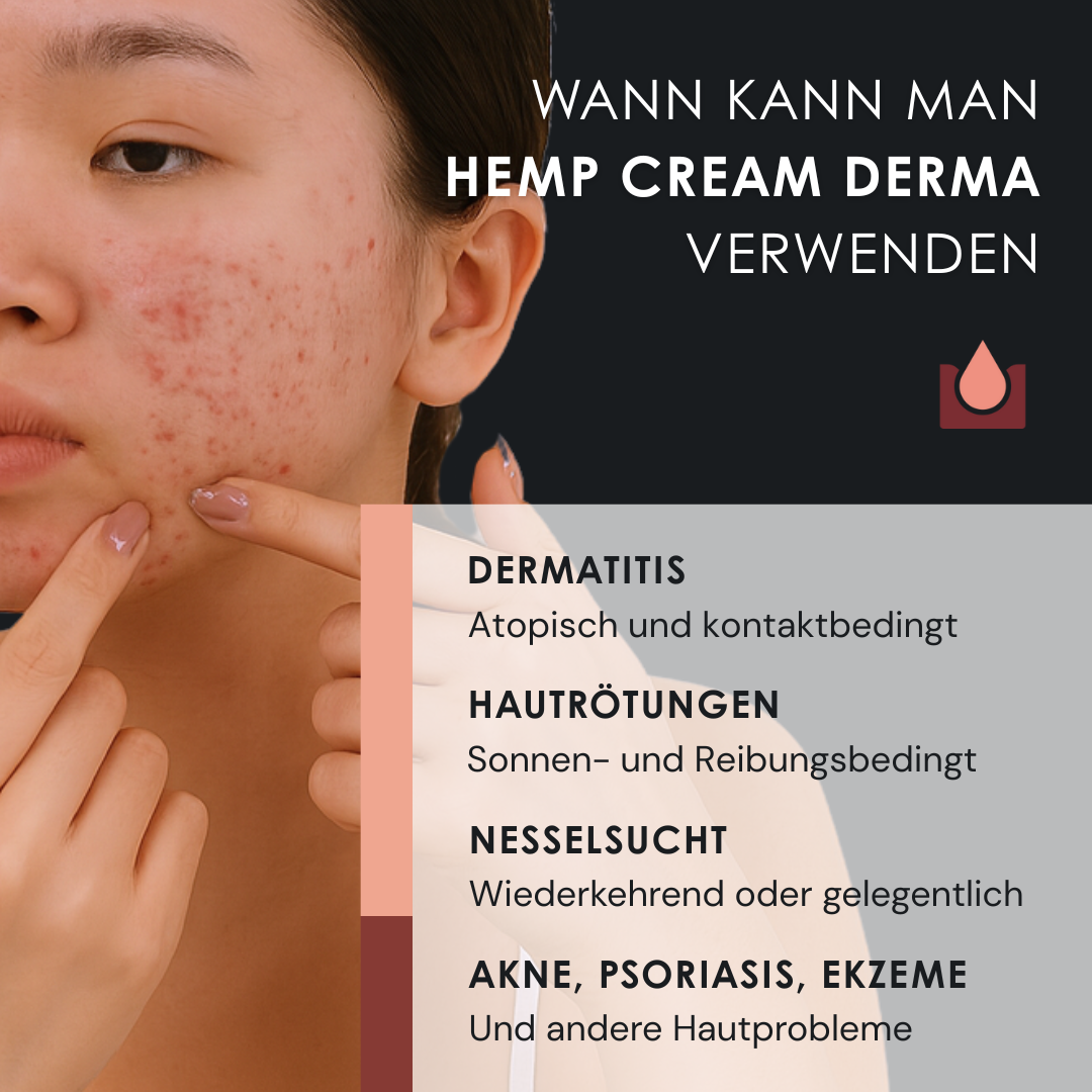 EU4DERMA - Natürliche Beruhigungscreme für Gesicht und Körper bei Ekzemen, Akne und Schuppenflechte - 50 ml
