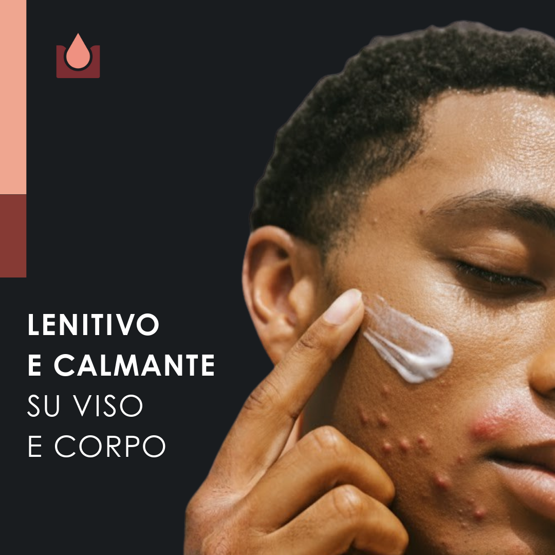 Crema naturale per acne - 2x50ml-10388154909019