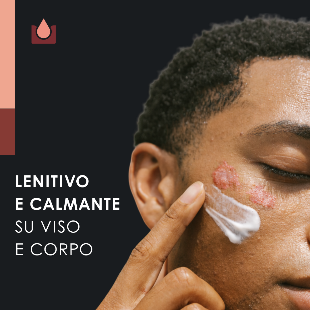 Crema naturale per psoriasi - 2x50ml