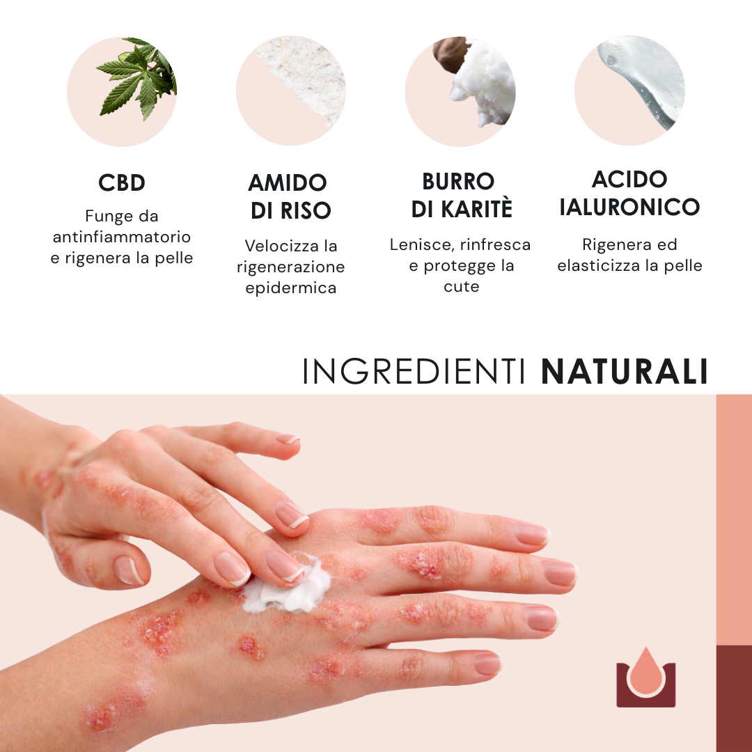 Crema naturale per psoriasi - 2x50ml