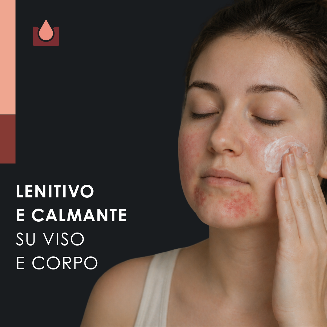 Crema naturale per dermatite seborroica - 2x50ml